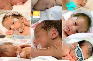 Опубликованы первые [снимки чудо-восьмерки близнецов]