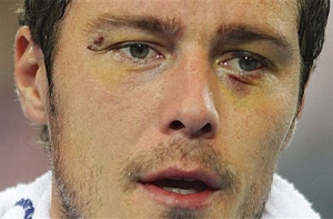 Марат Сафин выбыл [из турнира в Монте-Карло]