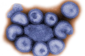 Вчера было выявлено [33 заболевших вирусом AH1N1]