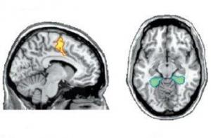 Пациента в вегетативном состоянии научили общаться