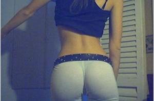 Хирург увеличивал пациенткам ягодицы с помощью строительного герметика