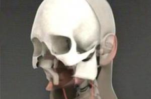 Испанцу восстановили отстреленное лицо