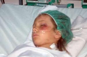 Выжившему в авиакатастрофе мальчику сделали операцию