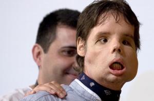 Человек с перекроенным лицом вышел в свет