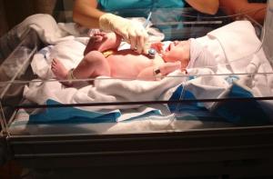 Кесарево сечение вредит младенцу