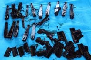 Начинающий ниндзя проглотил 15 пар кусачек для маникюра