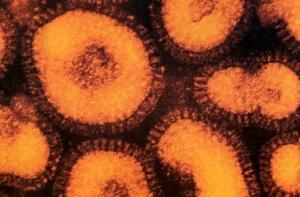 Вирус ВИЧ оказался очень древним