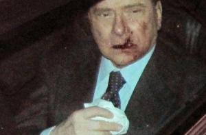 Берлускони пересадили фрагмент челюсти