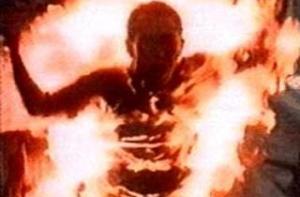 Поджегшая себя гражданка лечилась в психиатрической клинике