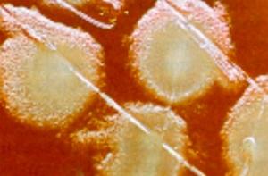 Половина мясных продуктов в США заражена стафилококком