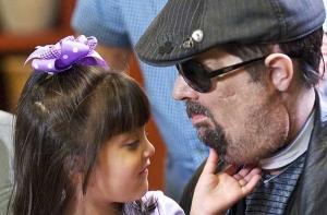 Операция по полной пересадке лица - пациент показался на публике