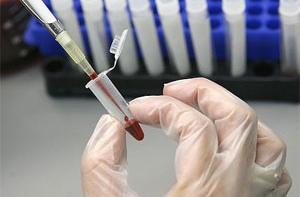 Ученые научились предсказывать судьбу человека по тесту крови