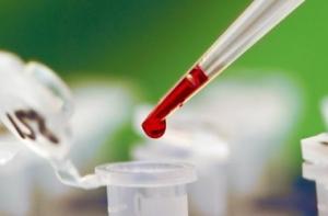 Ученые США разработали препараты для излечения рака