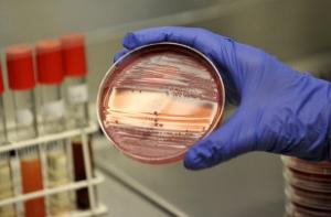 Бактерию E.coli нашли в бутилированной воде