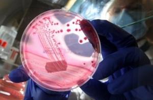 Число жертв кишечной палочки в Европе выросло до 50 человек