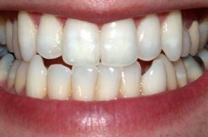 В Японии старик покусал полицейского за его медлительность