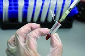 Эксперт: инфекция Krājbanka - не заразная