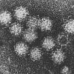 Установлен вирус эпидемии в Агенскалнской школе (АУДИО, ДОПОЛНЕНО)