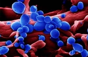 В Китае впервые за полтора года от птичьего гриппа умер человек