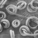 Больше 20 человек заболели трихинеллезом