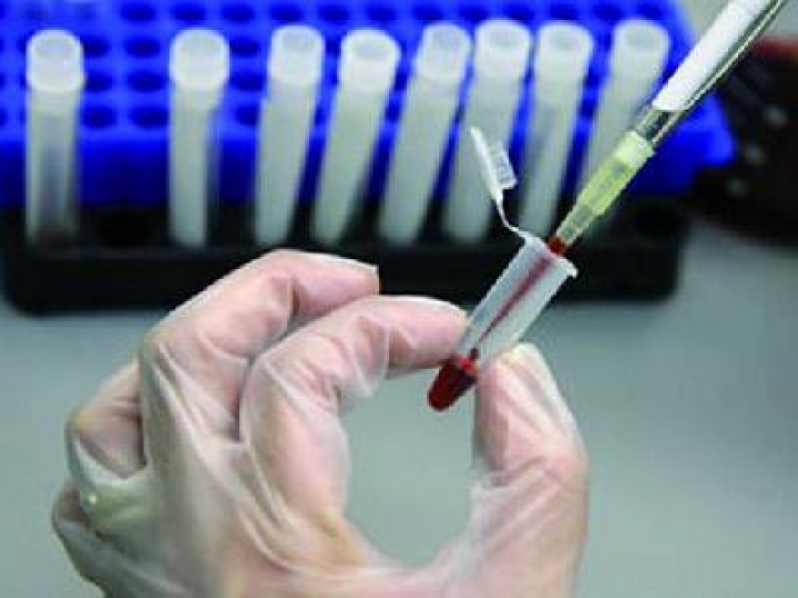 В Латвии становится все больше ВИЧ-инфицированных