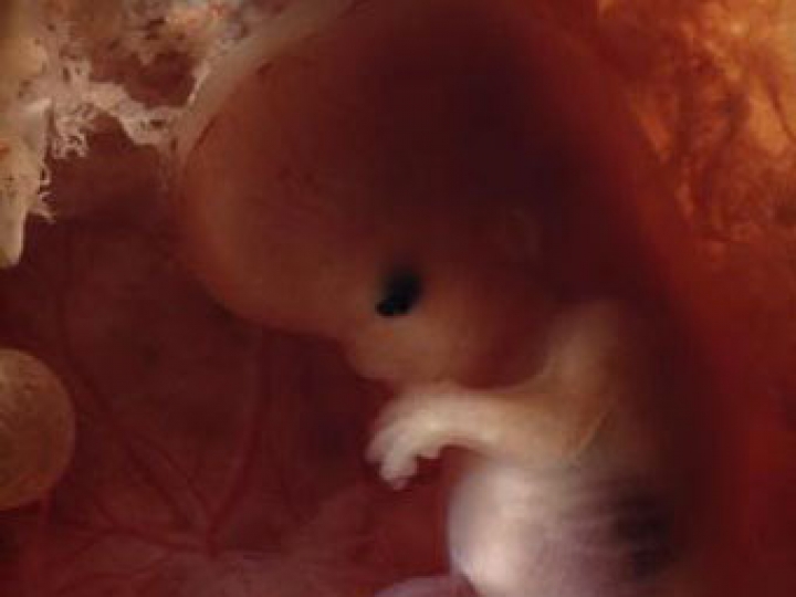 Депутаты собрались защищать эмбрионов