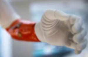 Мужчине вживили «руку Микеланджело»