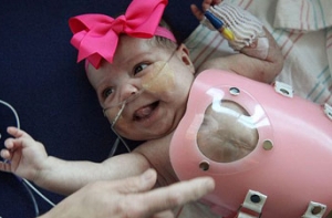 Малышке с сердцем наружу подарили специальный щит (ФОТО)