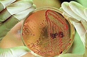 Российские ученые обнаружили новый тип бактерий