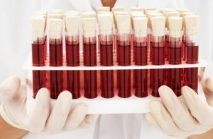 В Норвегии воспитательница напоила детсадовцев кровью