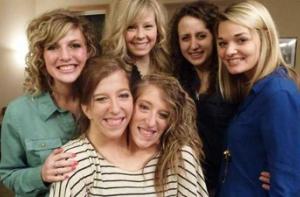 Сиамские близнецы с двумя дипломами получают одну зарплату на двоих