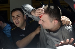 В Тбилиси во время гей-акции пострадали 17 человек (ФОТО, ВИДЕО)