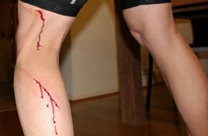 Кенгуру избил австралийского политика