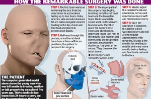 Врачи подарили изуродованному мужчине новое лицо (ВИДЕО)