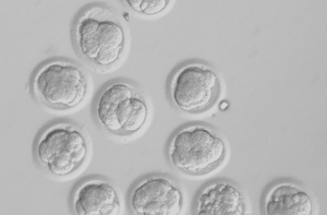 В Шотландии успешно ввели стволовые клетки инвалидам