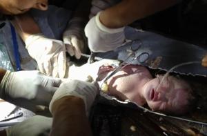 В Китае новорожденного спасли из канализационной трубы (ВИДЕО)