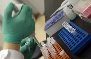 Ученые смогли отключить хромосому «дауна»