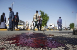 В Москве кавказцы отрезали парню нос