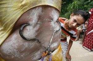 Причины болей в спине теперь известны