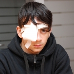 Лишившийся глаза в беспорядках 13 января юноша отправился в заключение (ВИДЕО)