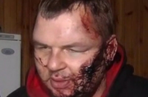 Лидер «Автомайдана» обвинил в своем похищении спецназ