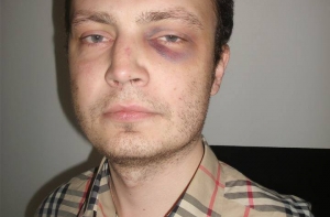 Антифашиста Кузинса снова избили