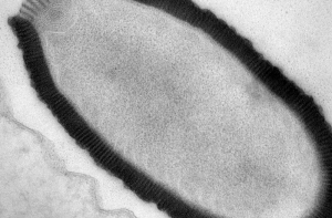 Человечеству угрожают опасные вирусы (ВИДЕО)