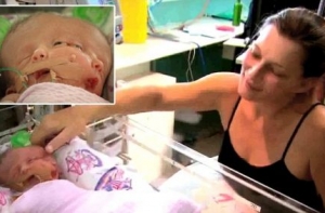 Австралийка родила двуликого младенца (ВИДЕО)