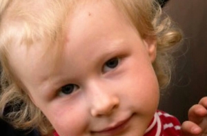 «Зеленая лампа»: для 3-летней Ники собрано 1300 евро