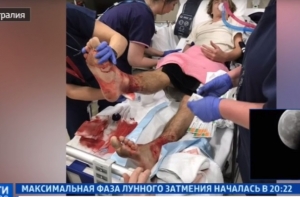 В Австралии голодные рачки обгладывают ноги купальщиков