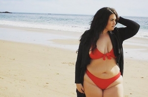 Девушка с редкой болезнью стала Instagram-сенсацией