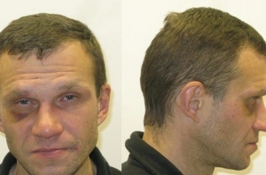 Разыскивается сбежавший из психбольницы опасный пациент