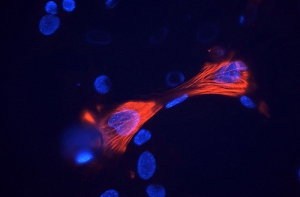 Нобелевскую премию по медицине присудили за новые методы лечения рака