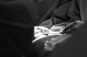 Медики забрали почки убитого мужчины без разрешения родственников